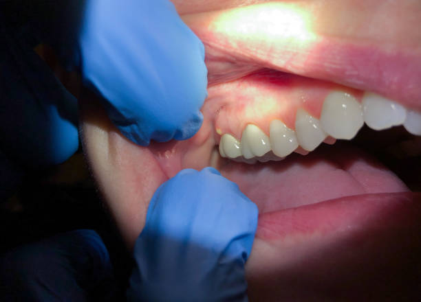 Best Emergency Cosmetic Dentistry (e.g., broken veneers) in Vail, AZ
